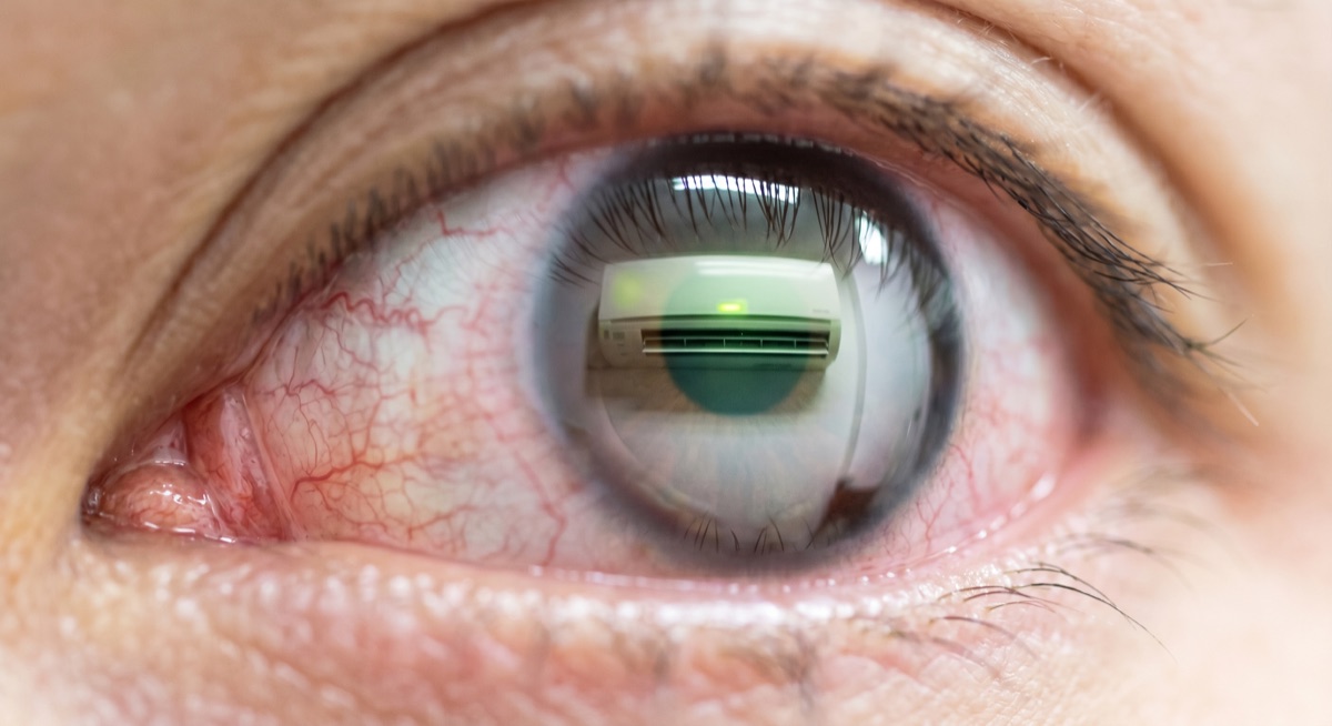 ตาแดง ระคายเคือง จากแอร์ แก้ยังไง คำตอบตรงจากนักทัศนมาตร 2026